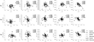 Choroidal Vascularity Index Changes After Exercise in Patients With Glaucoma